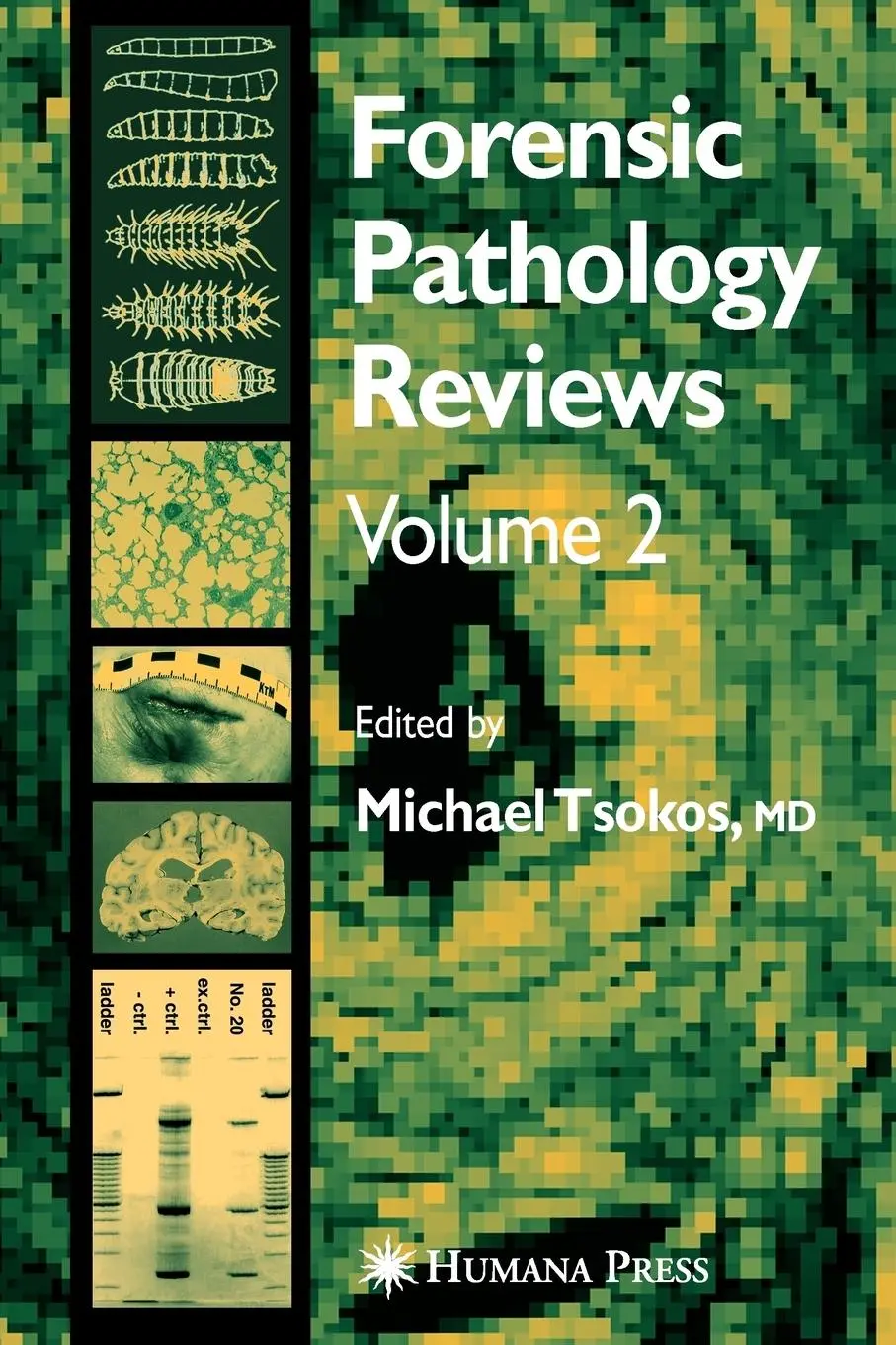 Cover: 9781617375514 | Forensic Pathology Reviews Vol 2 | Michael Tsokos | Taschenbuch | xvi