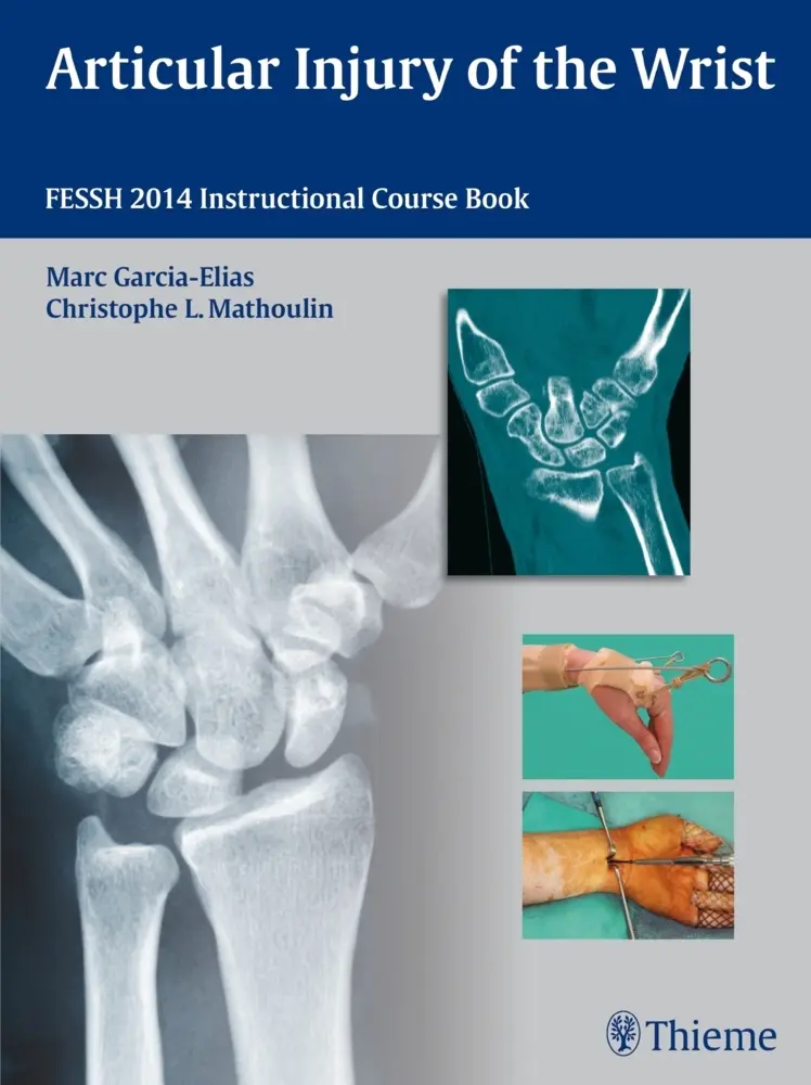 Cover: 9783131746214 | Articular Injury of the Wrist | FESSH 2014 Instructional Course Book