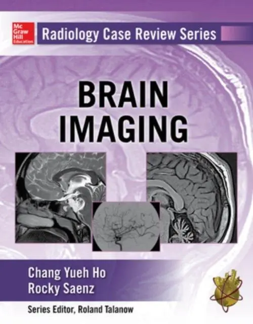 Cover: 9780071826914 | Radiology Case Review Series: Brain Imaging | Chang Ho (u. a.) | Buch