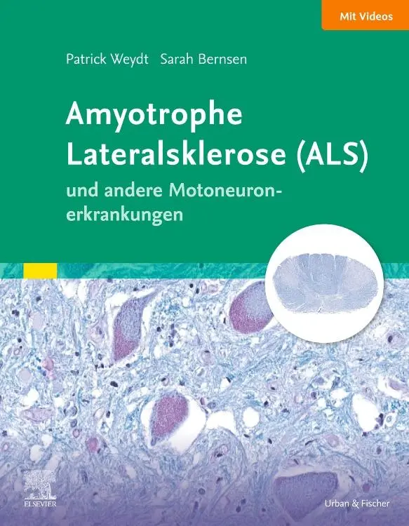 Cover: 9783437217814 | Amyotrophe Lateralsklerose (ALS) und andere Motoneuronerkrankungen