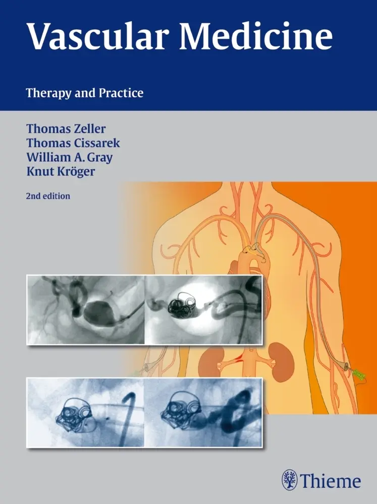 Cover: 9783131768414 | Vascular Medicine | Therapy and Practice | Zeller | Buch | 536 S.