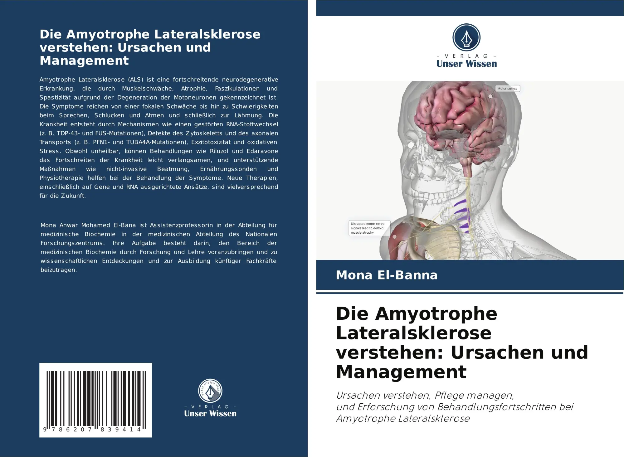 Cover: 9786207839414 | Die Amyotrophe Lateralsklerose verstehen: Ursachen und Management