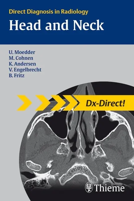Cover: 9783131440815 | Head and Neck Imagaging | Ulrich Moedder (u. a.) | Taschenbuch | 2025
