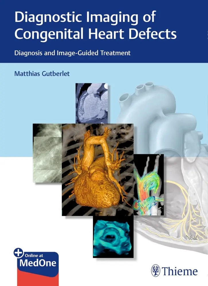 Cover: 9783132402515 | Diagnostic Imaging of Congenital Heart Defects | Matthias Gutberlet