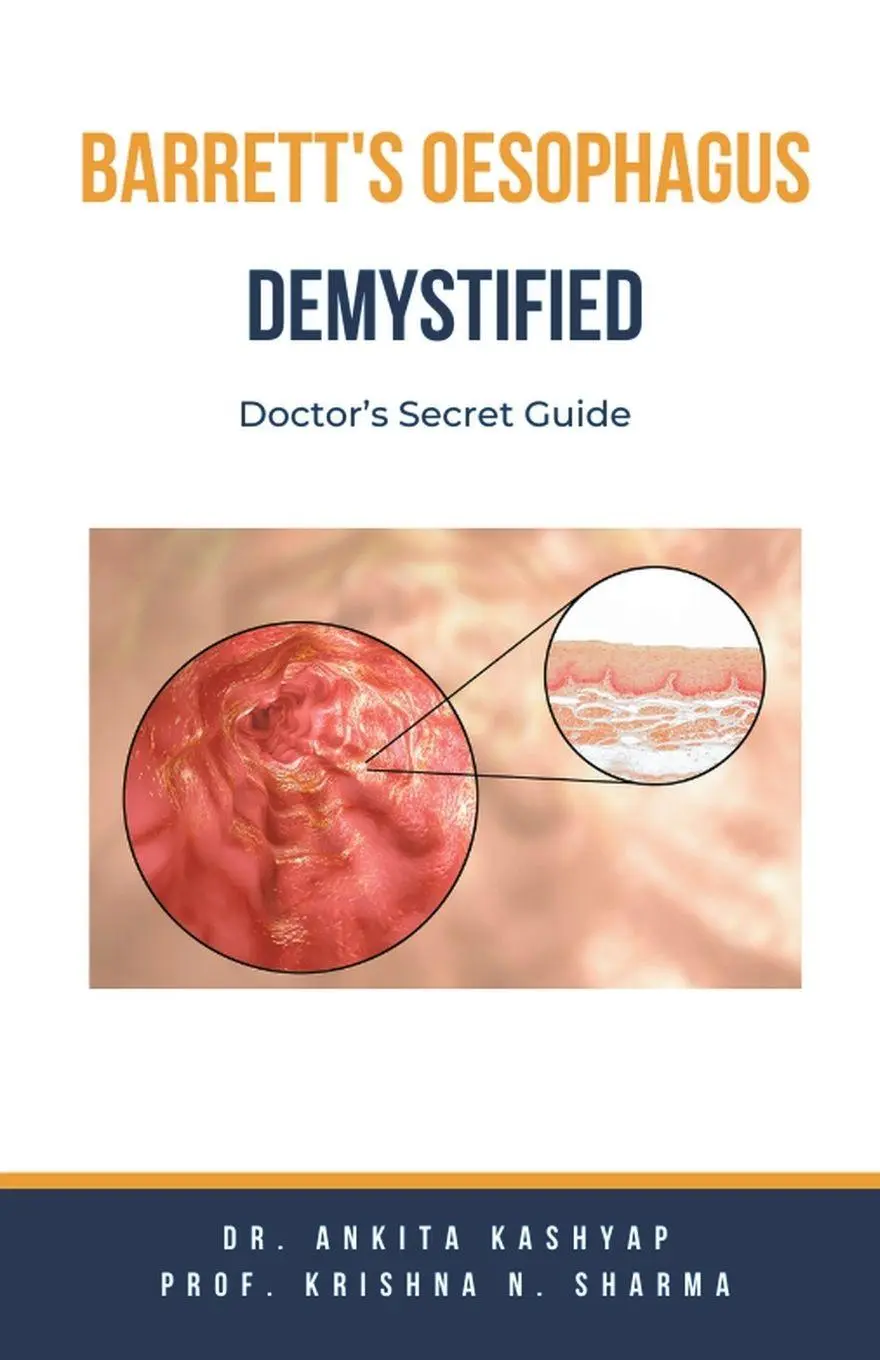 Cover: 9798223464815 | Barretts Oesophagus Demystified | Doctor's Secret Guide | Taschenbuch