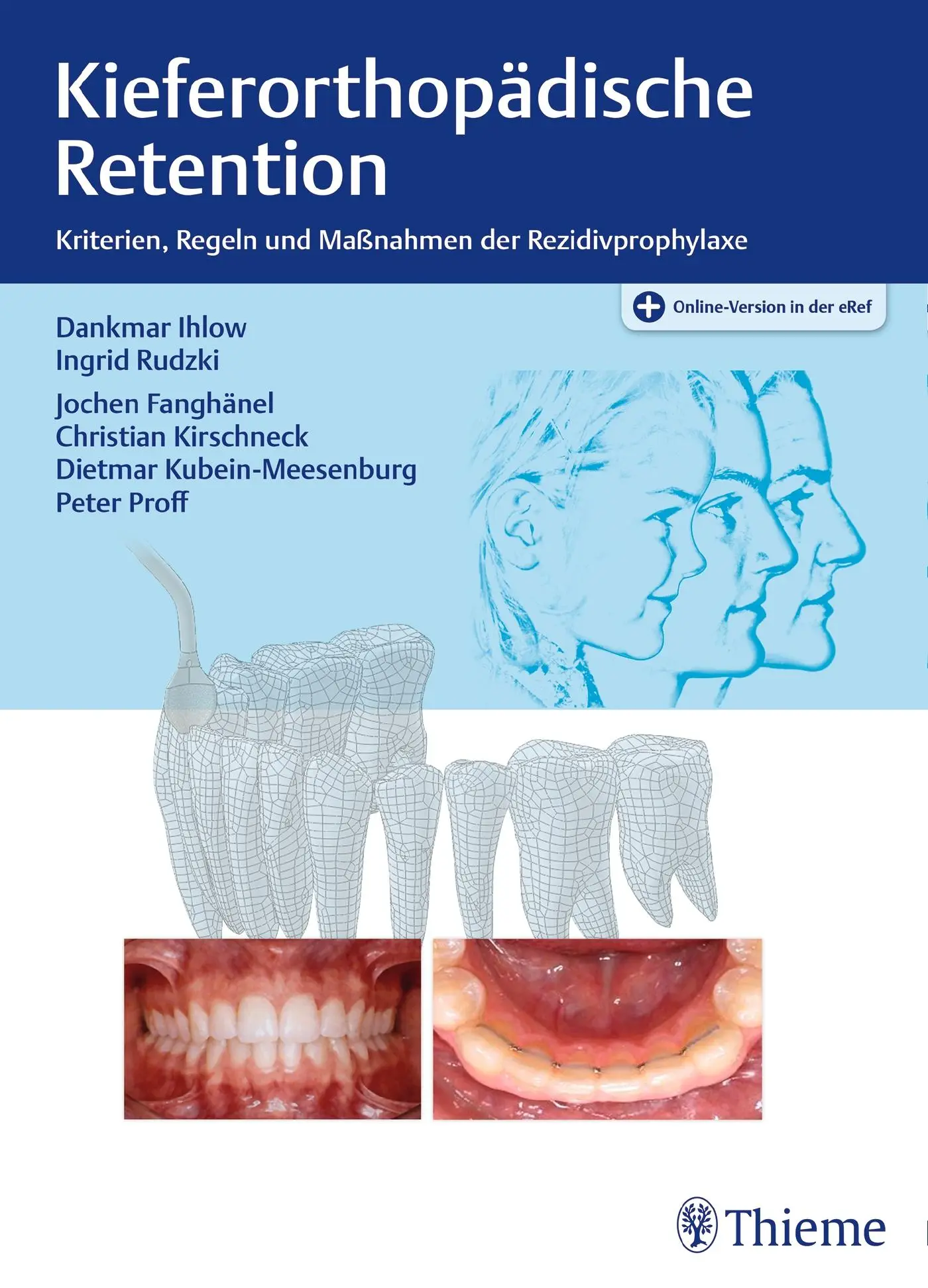 Kieferorthopädische Retention: Kriterien, Regeln und Maßnahmen der Rezidivprophylaxe