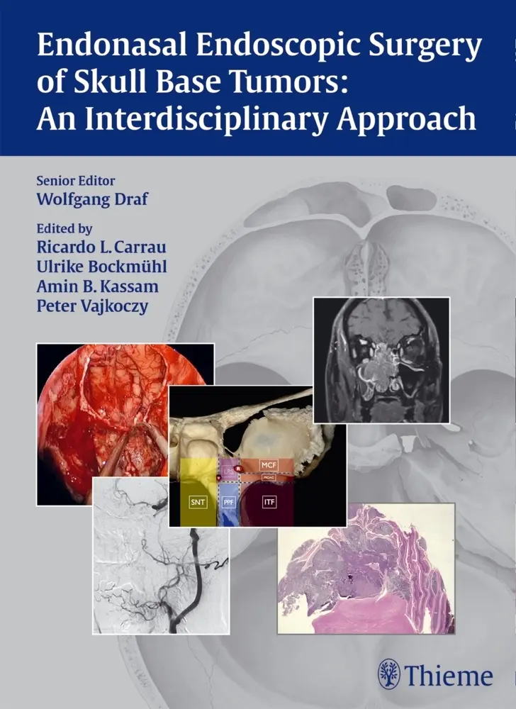 Cover: 9783131546715 | Endonasal Endoscopic Surgery of Skull Base Tumors | Draf | Buch | 2015
