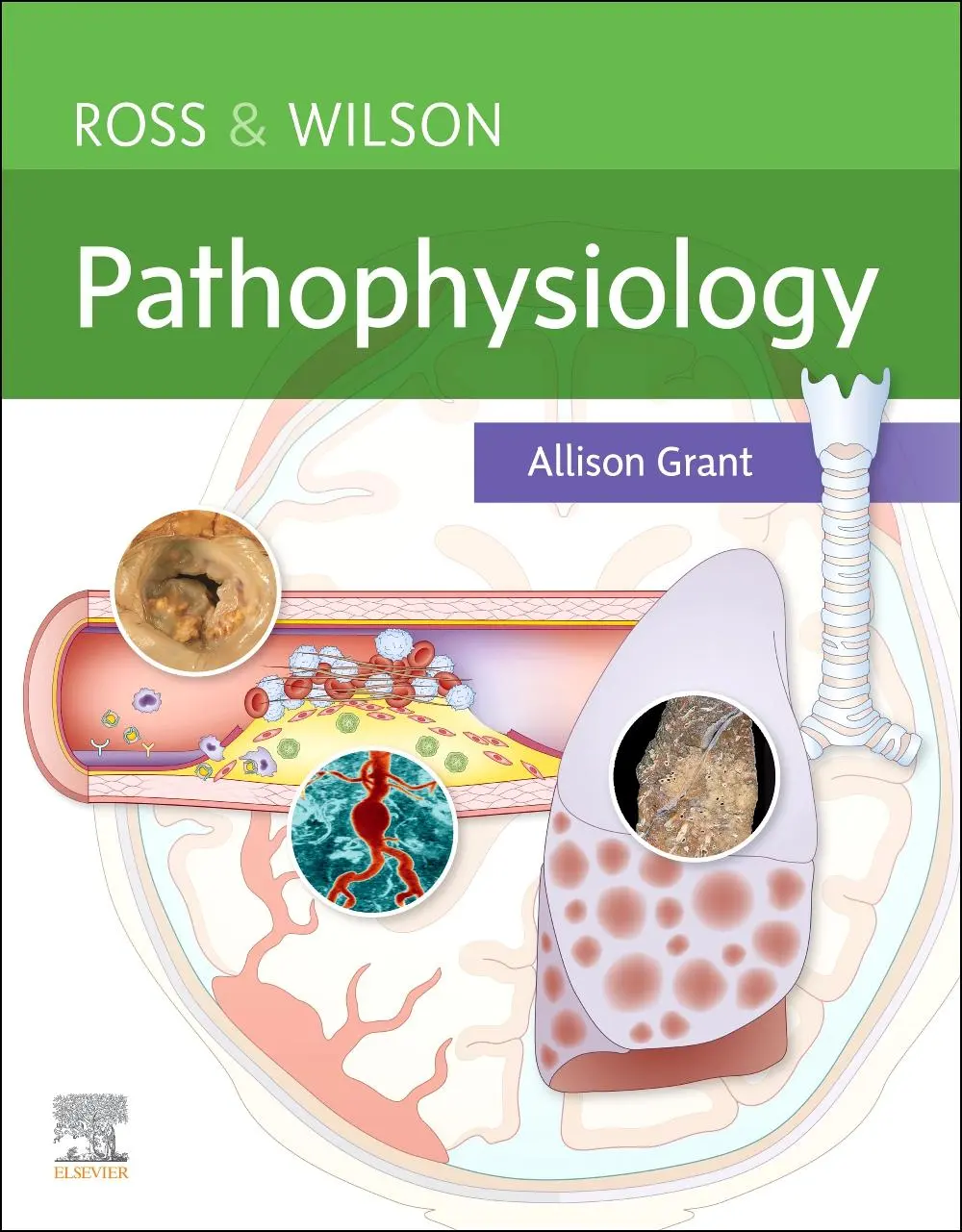 Cover: 9780702077715 | Ross &amp; Wilson Pathophysiology | Allison Grant | Taschenbuch | Englisch