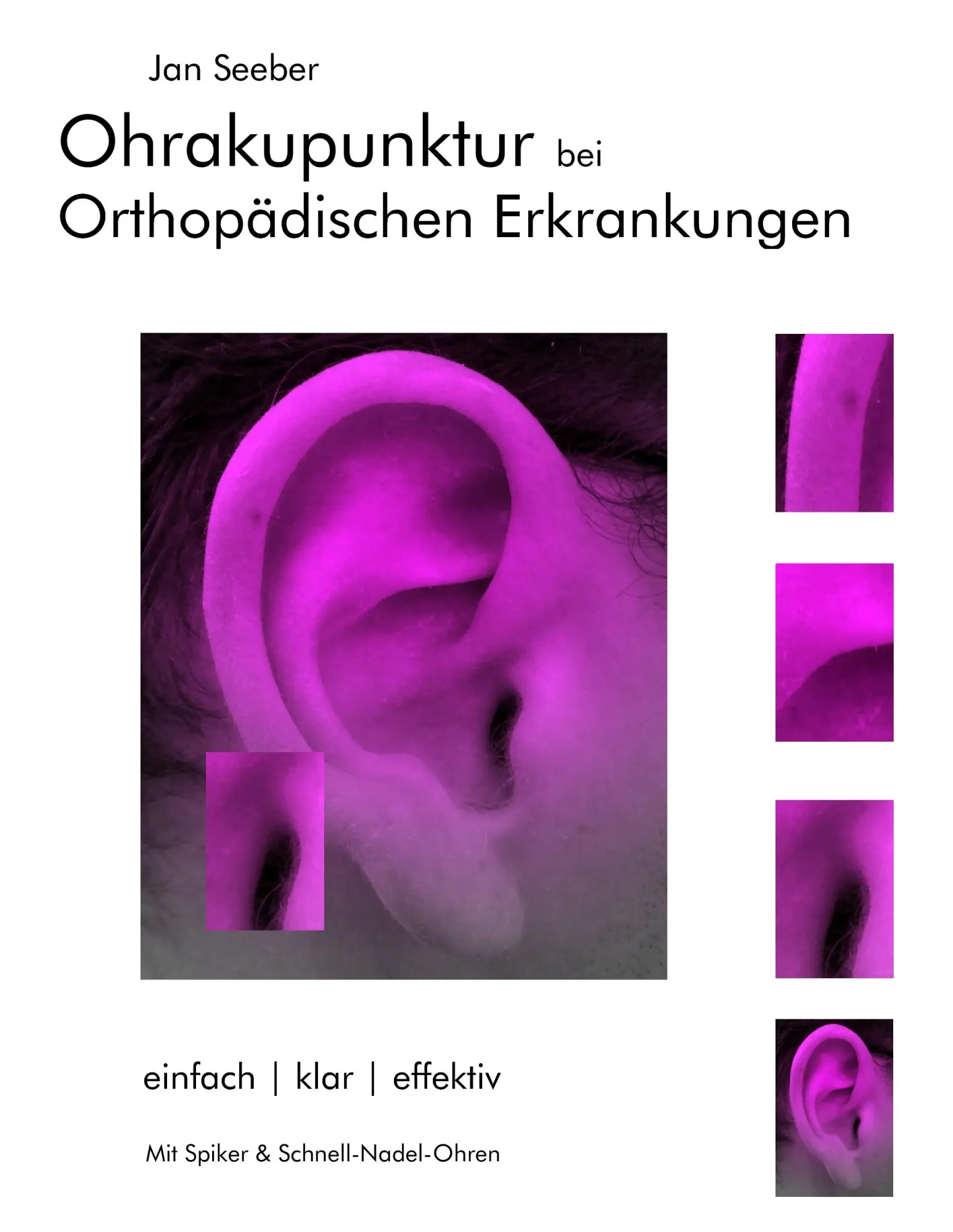 Cover: 9783837027815 | Ohrakupunktur bei Orthopädischen Erkrankungen | Jan Seeber | Buch
