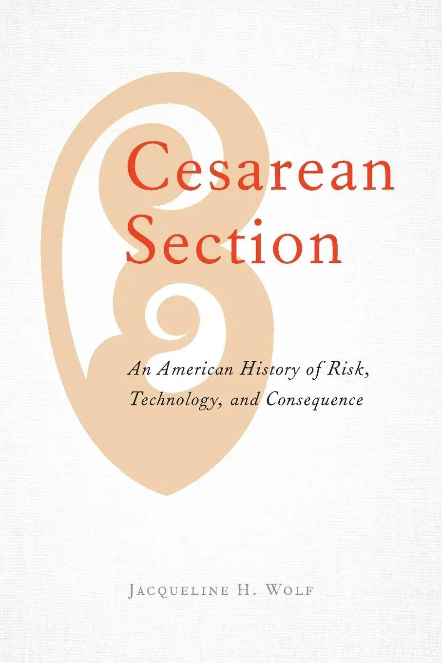 Cover: 9781421438115 | Cesarean Section | Jacqueline H Wolf | Taschenbuch | Englisch | 2020