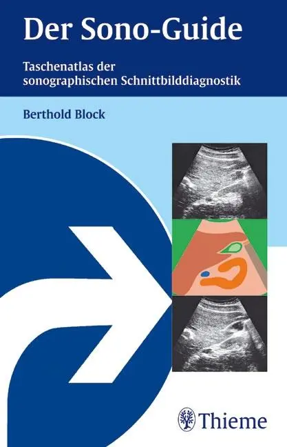 Cover: 9783131358615 | Der Sono-Guide | Berthold Block | Taschenbuch | 296 S. | Deutsch