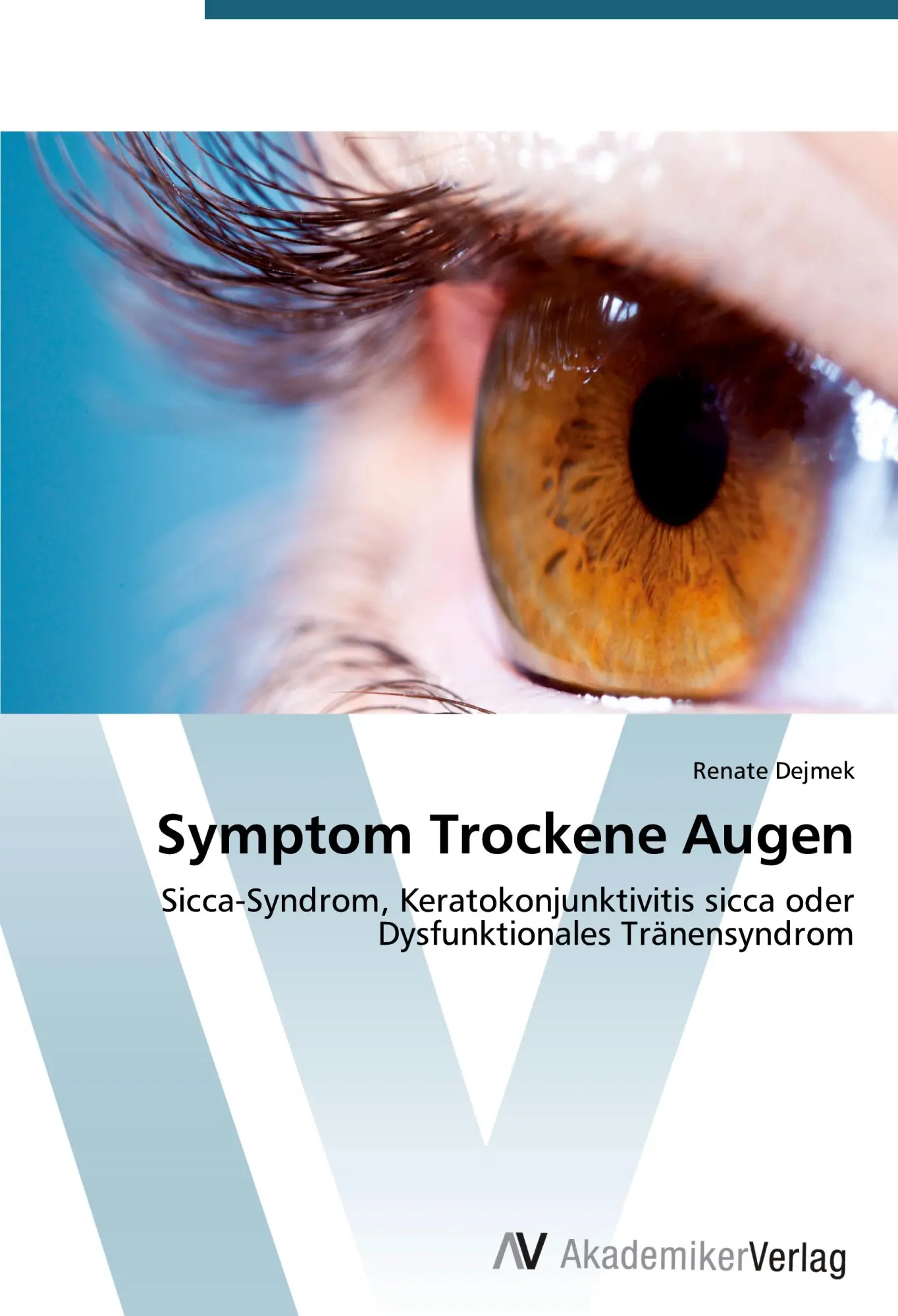 Cover: 9783639642216 | Symptom Trockene Augen | Renate Dejmek | Taschenbuch | Paperback