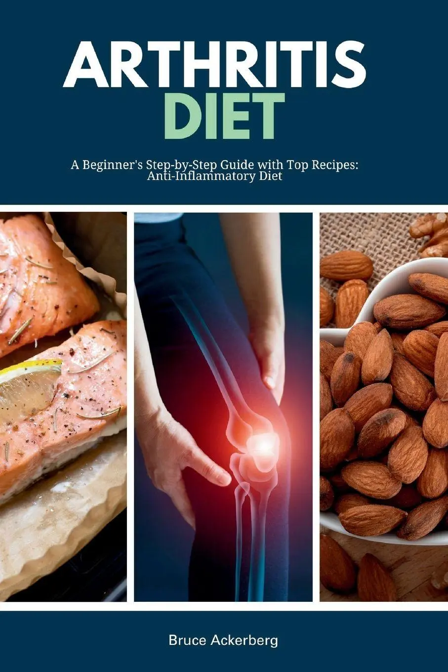 Cover: 9798869312716 | Arthritis Diet | Bruce Ackerberg | Taschenbuch | Englisch | 2024