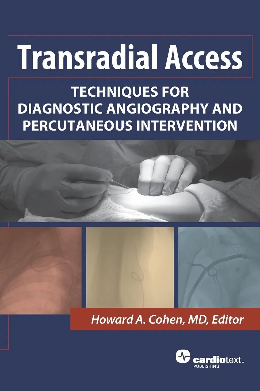 Cover: 9781935395416 | Transradial Access | Howard A Cohen | Buch | Gebunden | Englisch