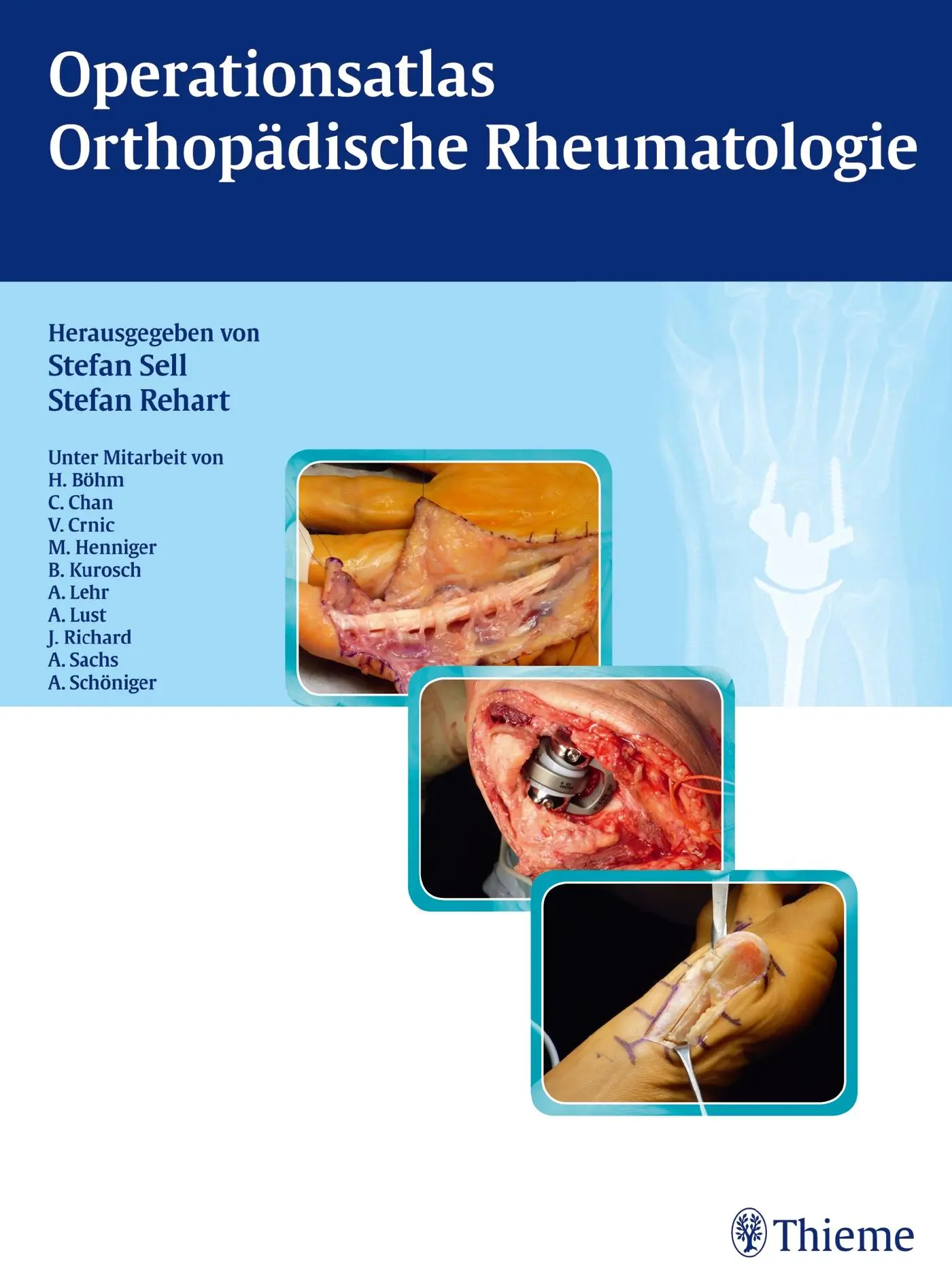 Cover: 9783131640017 | Operationsatlas Orthopädische Rheumatologie | Stefan Sell | Buch