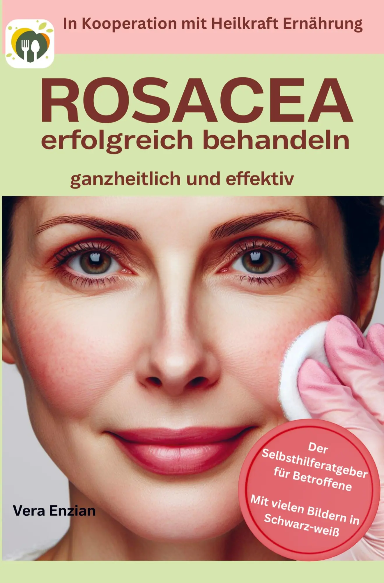 Cover: 9789403741017 | Rosacea erfolgreich behandeln - ganzheitlich und effektiv: Der...