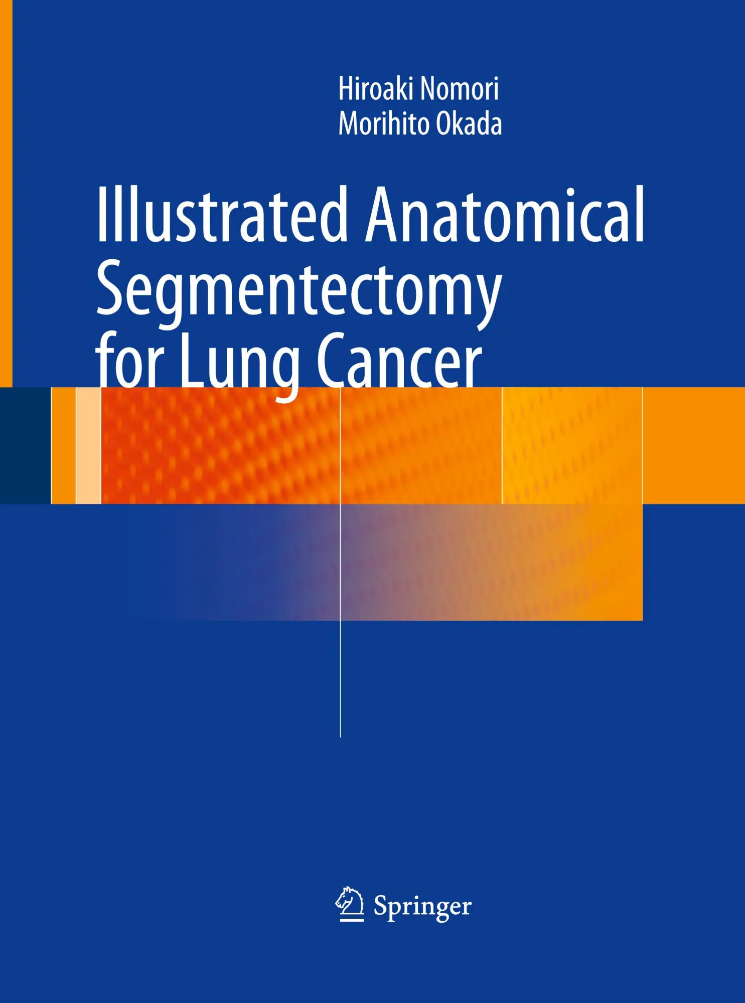Cover: 9784431561217 | Illustrated Anatomical Segmentectomy for Lung Cancer | Okada (u. a.)