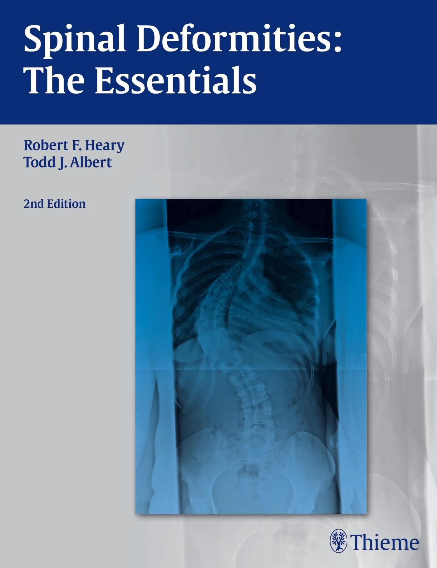Cover: 9781604064117 | Spinal Deformities | The Essentials | Robert F Heary (u. a.) | Buch