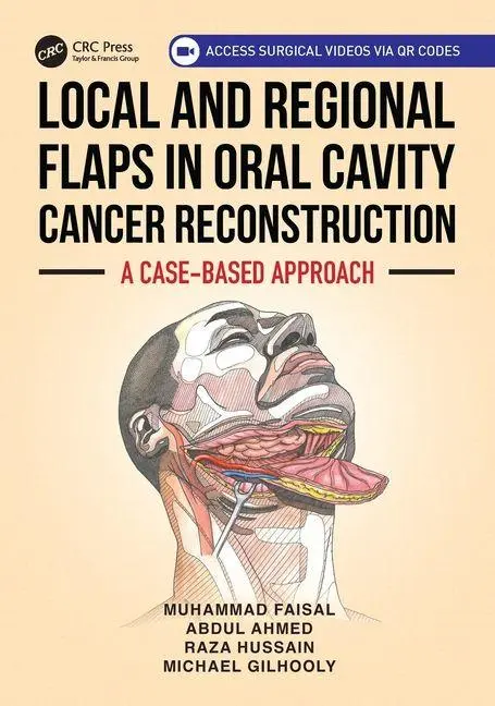 Cover: 9781032714417 | Local and Regional Flaps in Oral Cavity Cancer Reconstruction | Buch