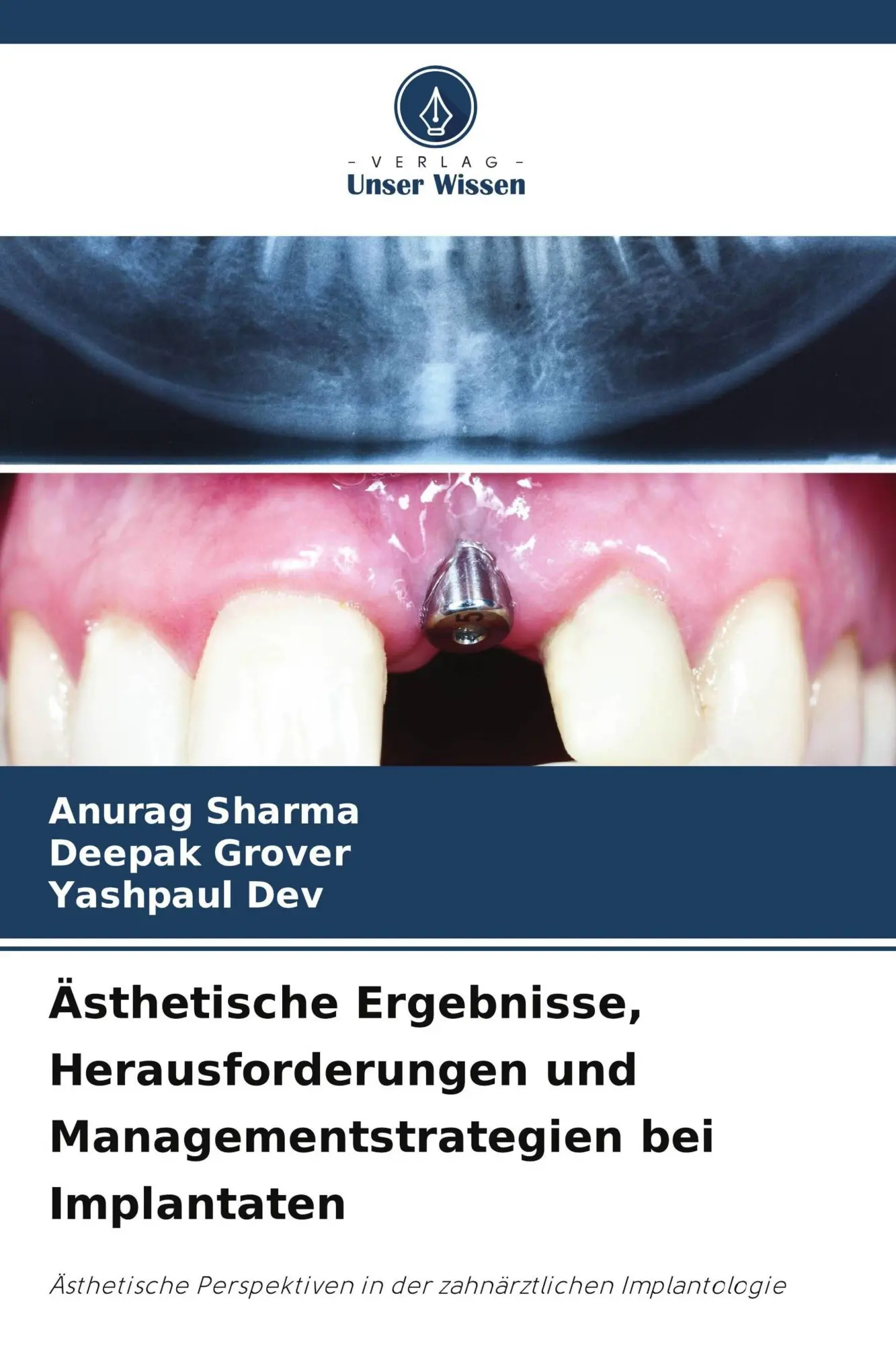Cover: 9786209698217 | Ästhetische Ergebnisse, Herausforderungen und Managementstrategien...