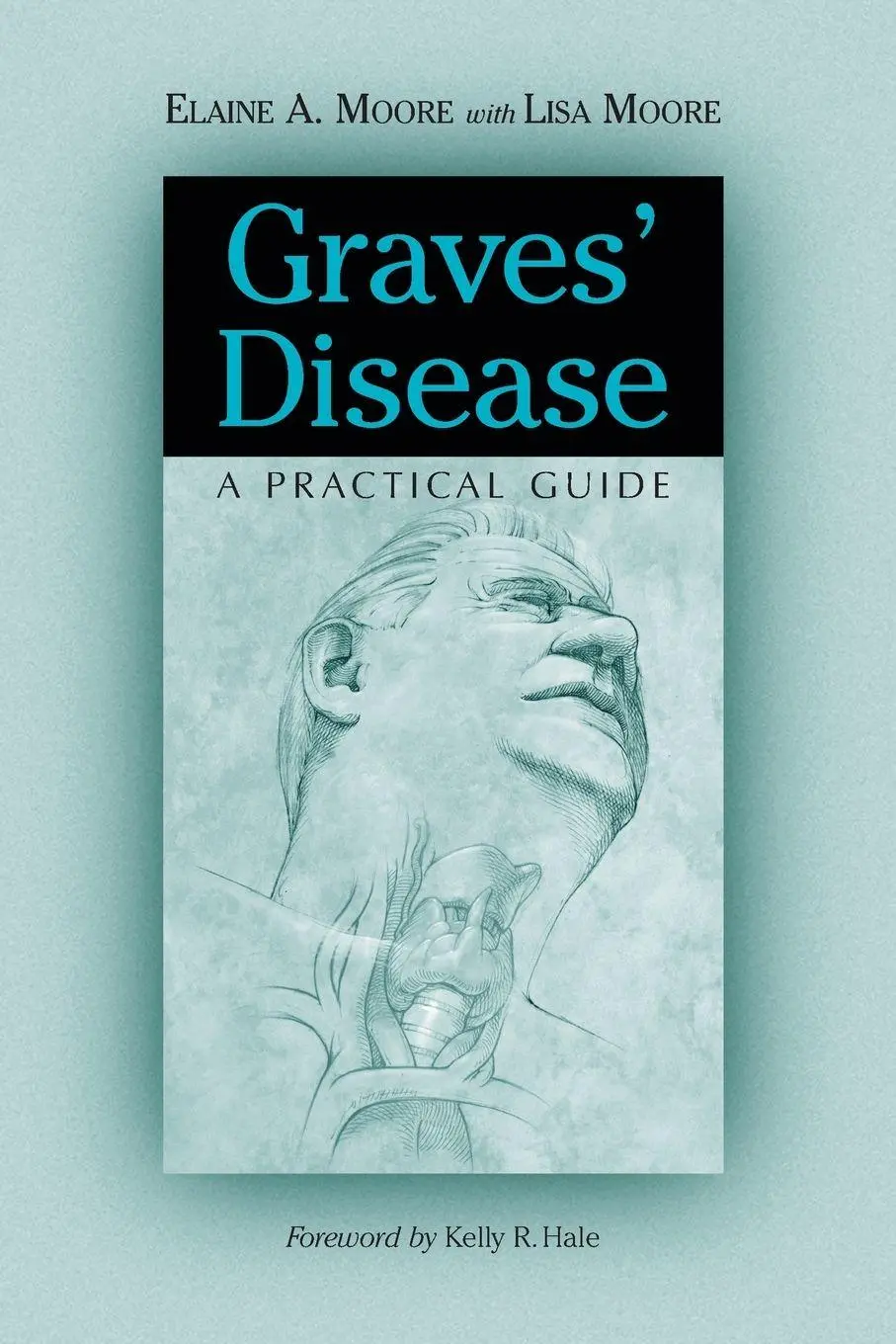 Cover: 9780786410118 | Graves' Disease | A Practical Guide | Elaine A. Moore | Taschenbuch