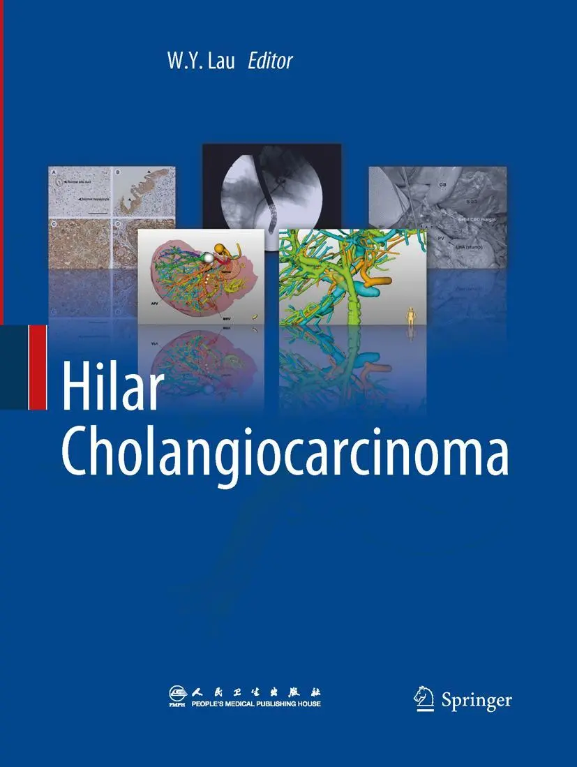 Cover: 9789401781718 | Hilar Cholangiocarcinoma | W. Y. Lau | Taschenbuch | Paperback | xvi