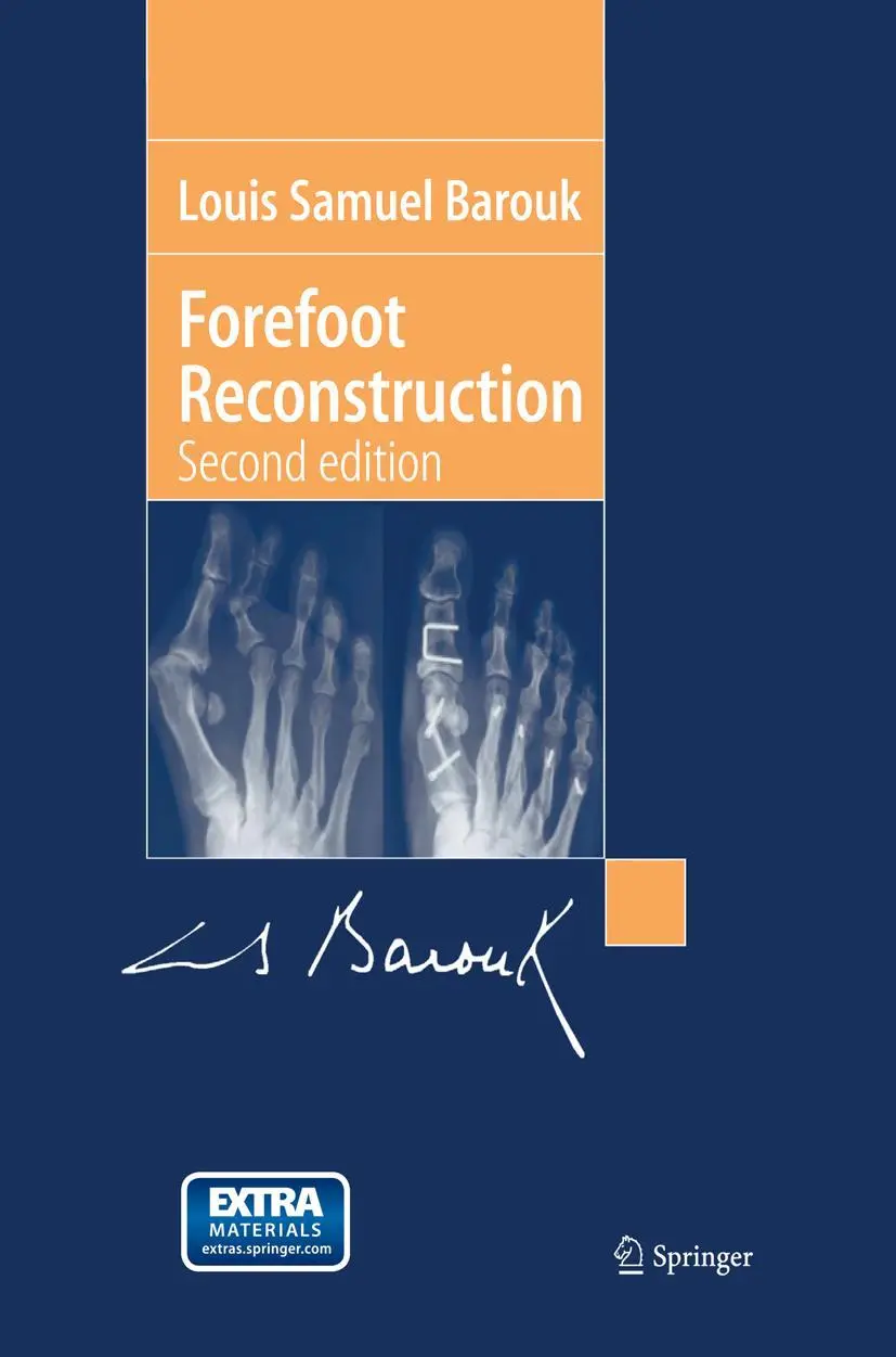 Cover: 9782287252518 | Forefoot Reconstruction | Louis-Samuel Barouk | Taschenbuch | 388 S.
