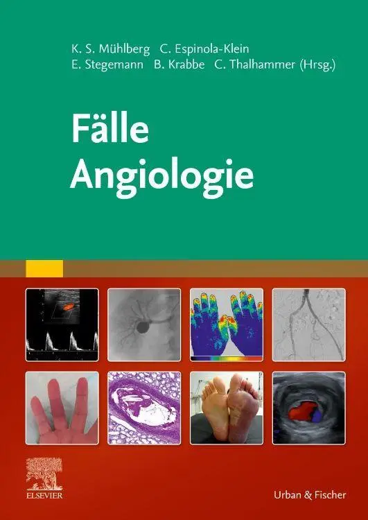 Cover: 9783437232718 | Fälle Angiologie | Katja S. Mühlberg (u. a.) | Taschenbuch | Fälle