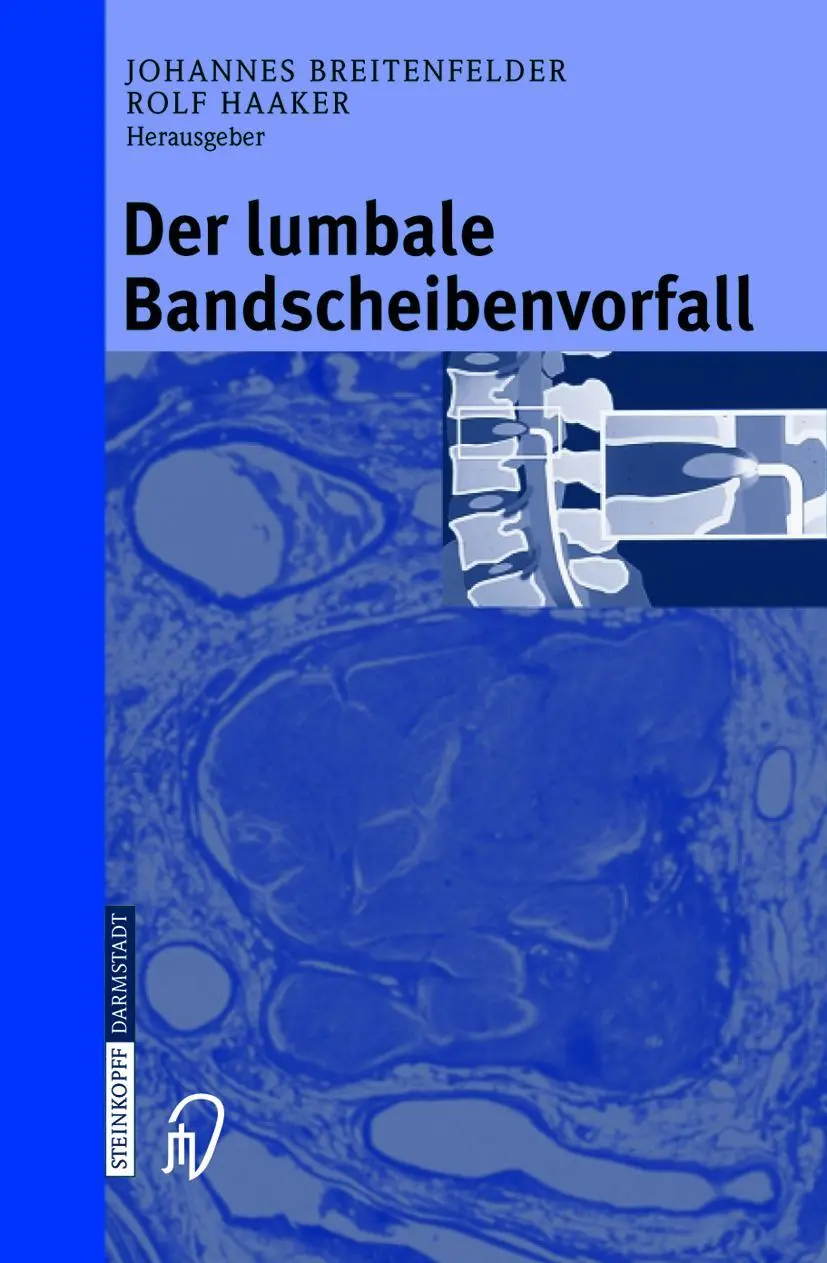 Cover: 9783798514218 | Der lumbale Bandscheibenvorfall | J. Breitenfelder (u. a.) | Buch