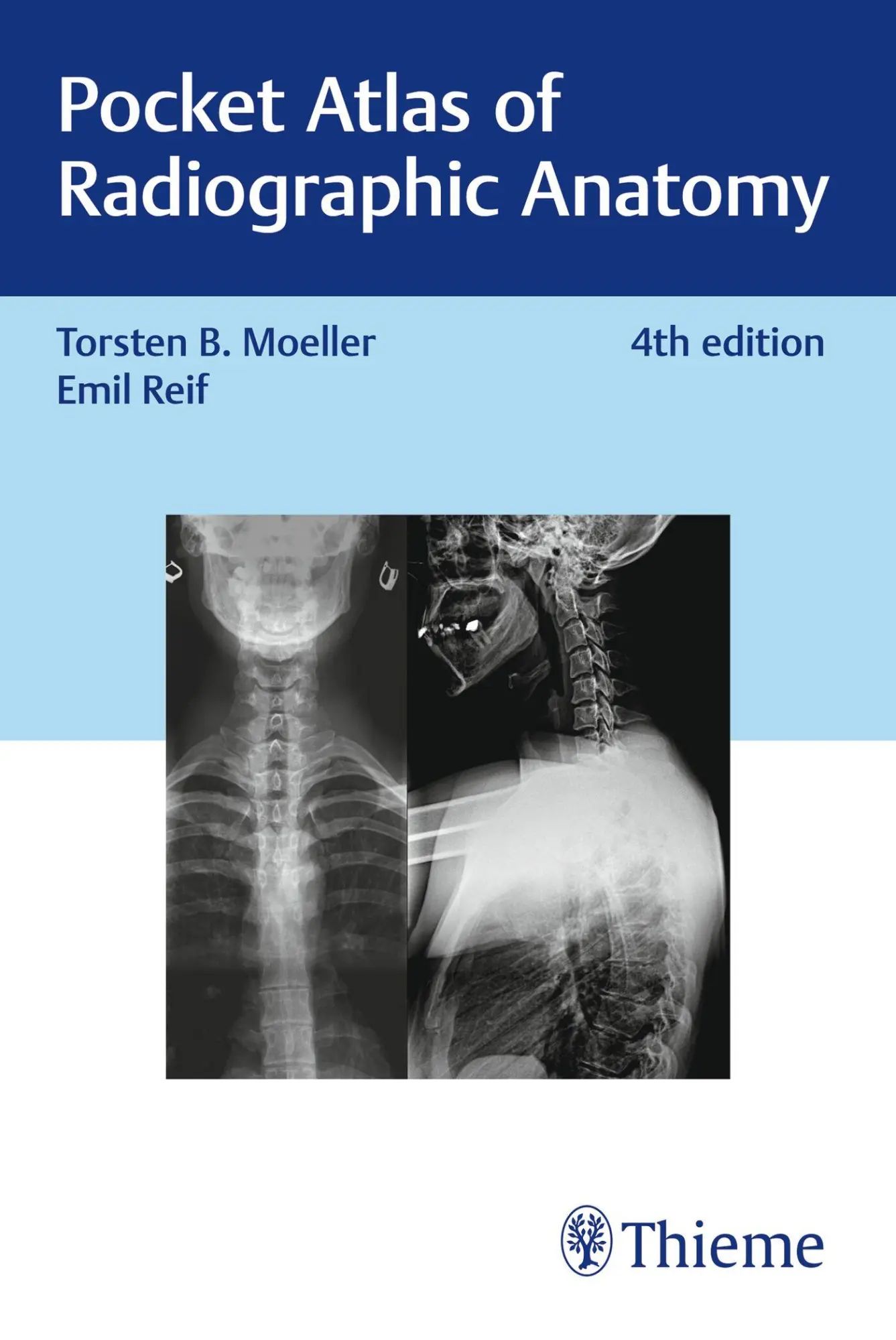 Cover: 9783132424418 | Pocket Atlas of Radiographic Anatomy | Torsten Bert Möller (u. a.)