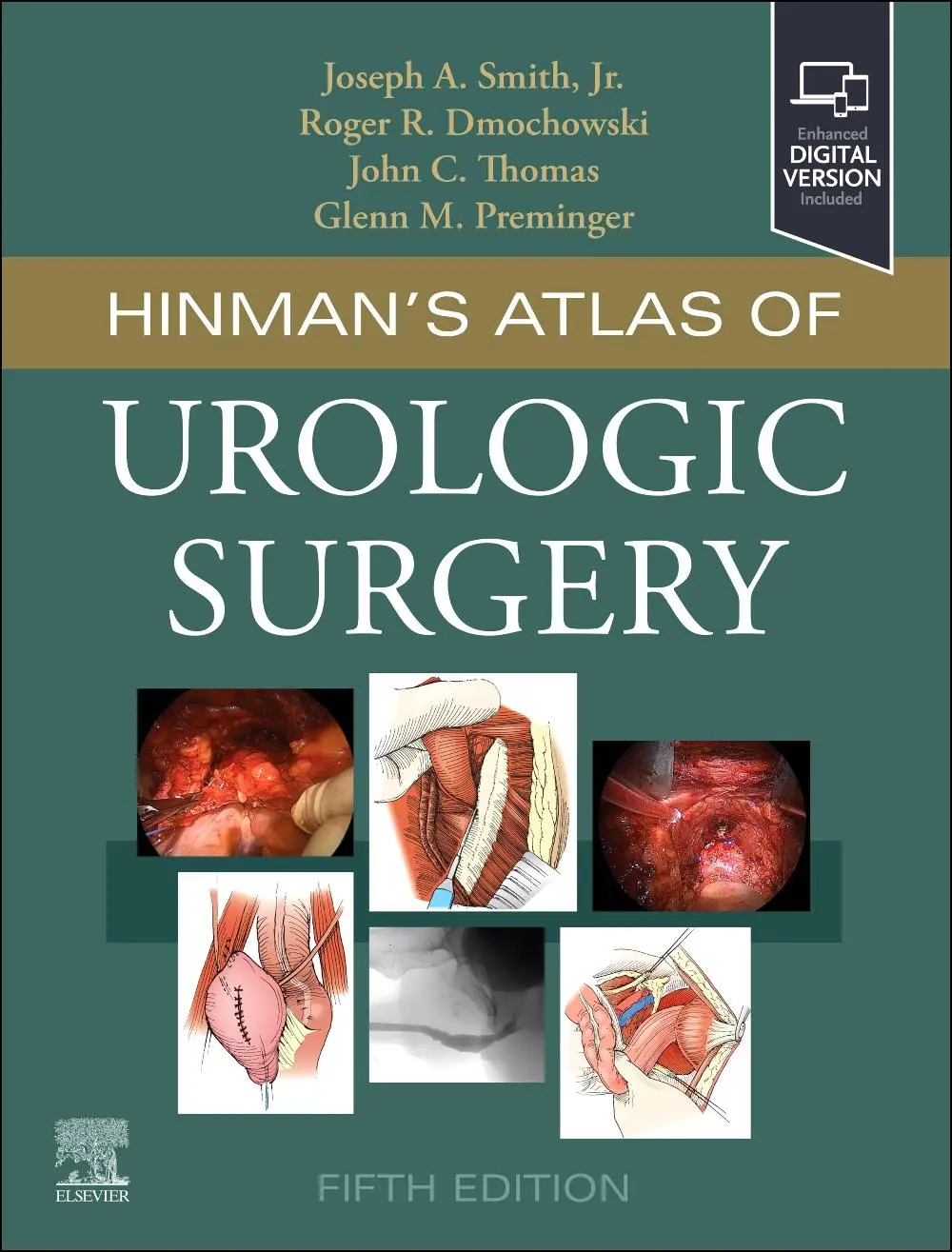Cover: 9780323936118 | Hinman's Atlas of Urologic Surgery | Joseph A. Smith Jr. (u. a.)