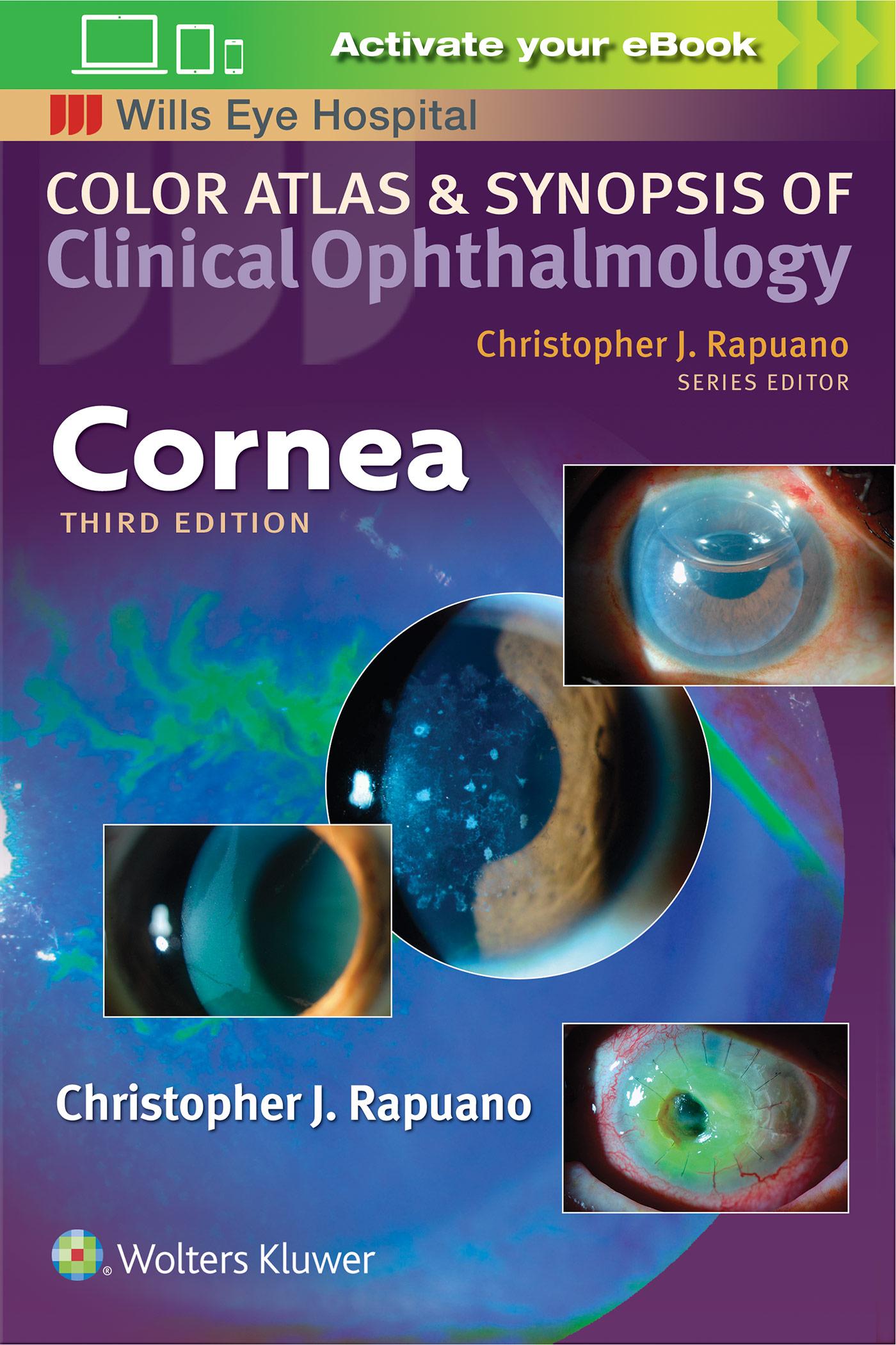 Cornea (Color Atlas and Synopsis of Clinical Ophthalmology) | Christopher J. Rapuano | Taschenbuch | Kartoniert / Broschiert | Englisch | 2018 | Lippincott Williams&Wilki | EAN 9781496366818 - Rapuano, Christopher J.