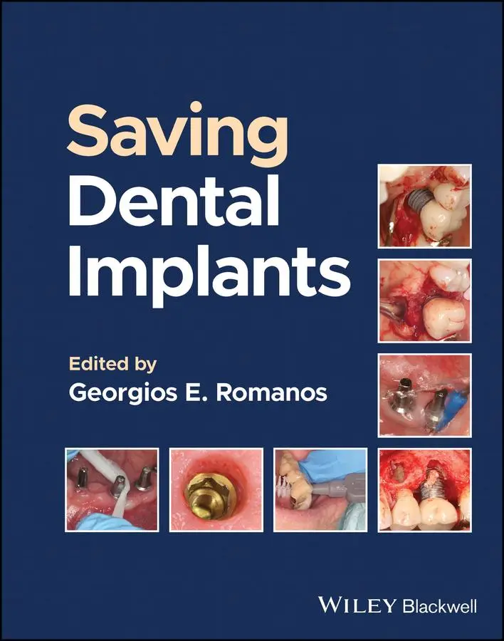 Cover: 9781119807018 | Saving Dental Implants | Georgios E Romanos | Buch | Gebunden | 2024
