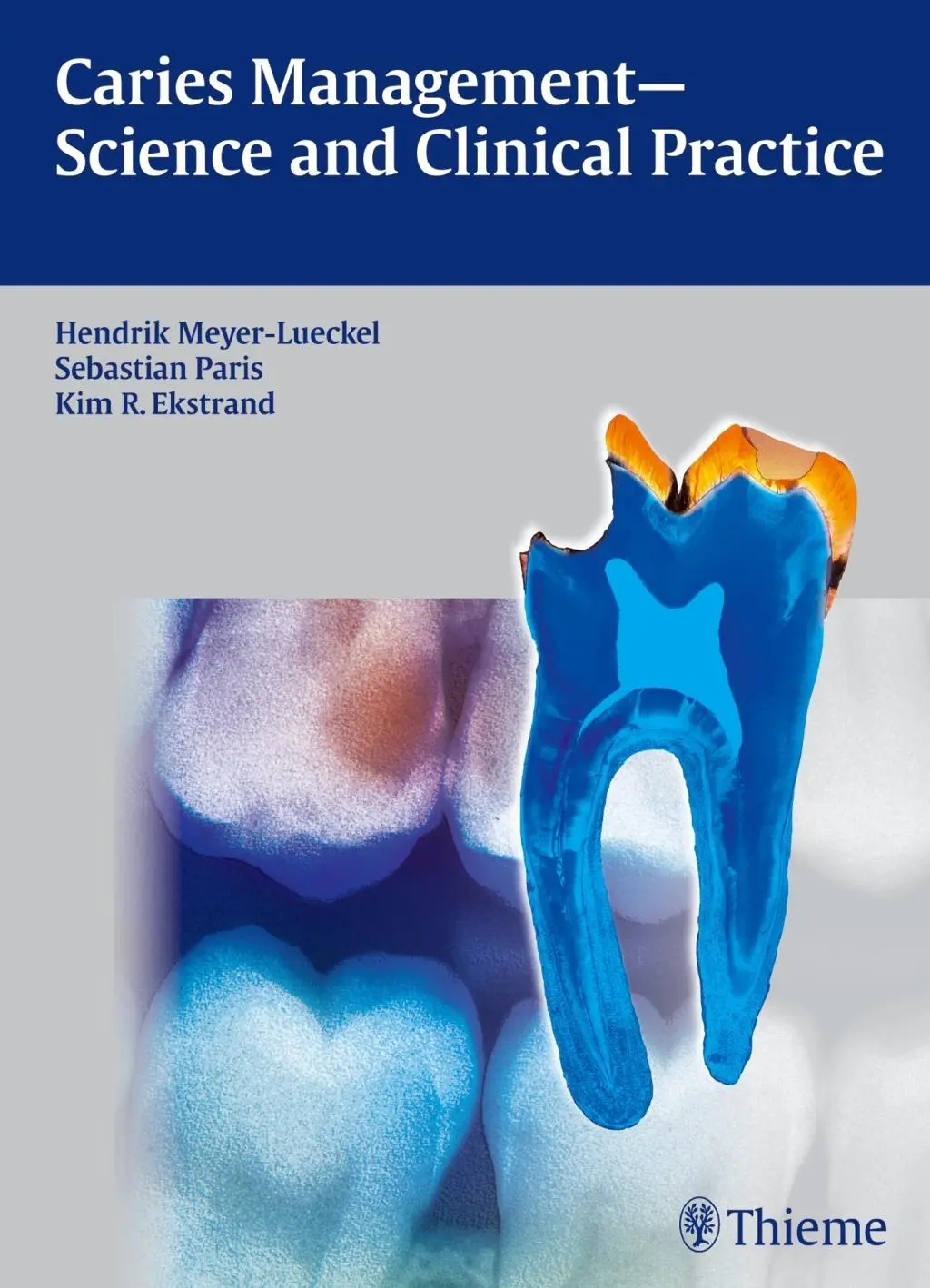 Cover: 9783131547118 | Caries Management - Science and Clinical Practice | Buch | 436 S.