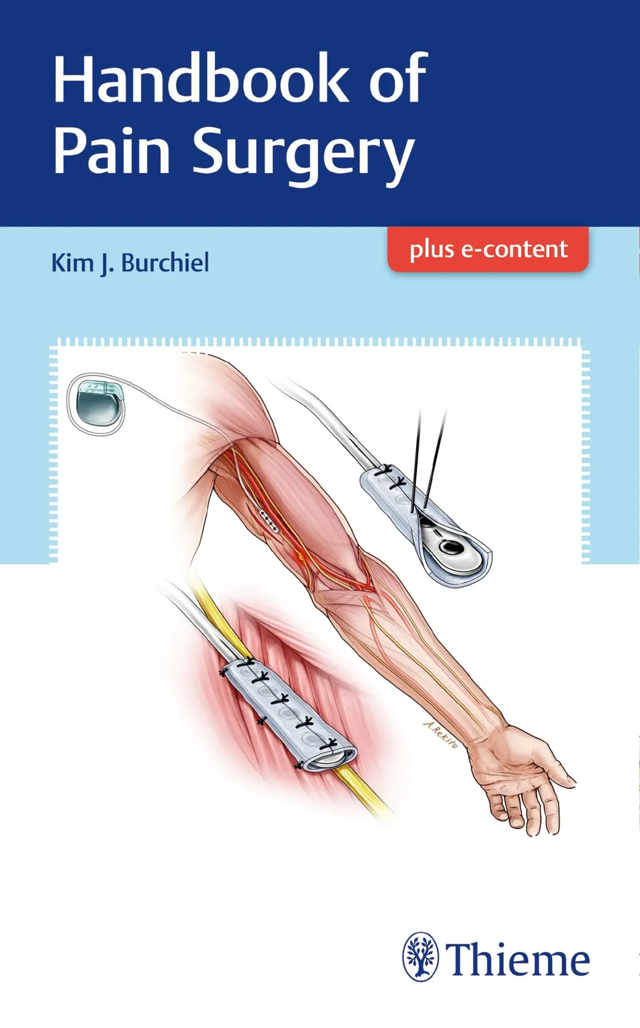 Cover: 9781626238718 | Handbook of Pain Surgery | Kim Burchiel | Taschenbuch | 400 S. | 2017
