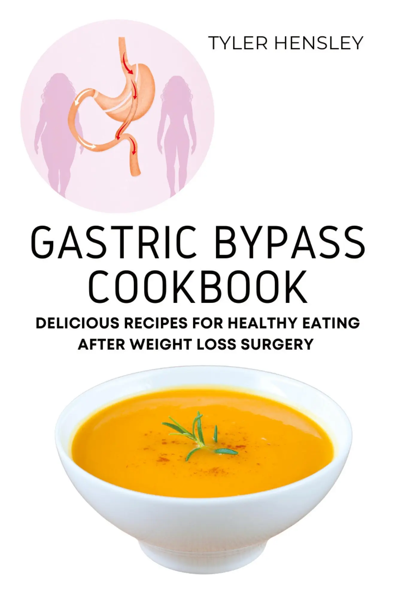 Cover: 9781803620619 | Gastric Bypass Cookbook | Tyler Hensley | Taschenbuch | Englisch