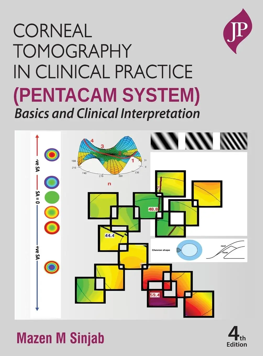 Cover: 9781787791619 | Corneal Tomography in Clinical Practice (Pentacam System) | Sinjab