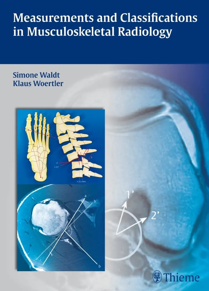 Cover: 9783131692719 | Measurements and Classifications in Musculoskeletal Radiology | Buch