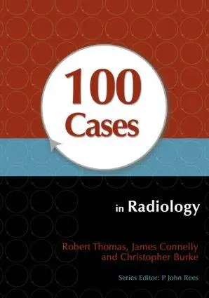 Cover: 9781444123319 | 100 Cases in Radiology | Christopher Burke (u. a.) | Taschenbuch