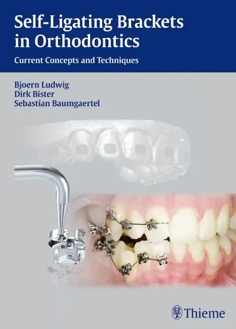 Cover: 9783131547019 | Self-ligating Brackets in Orthodontics | Björn Ludwig (u. a.) | Buch