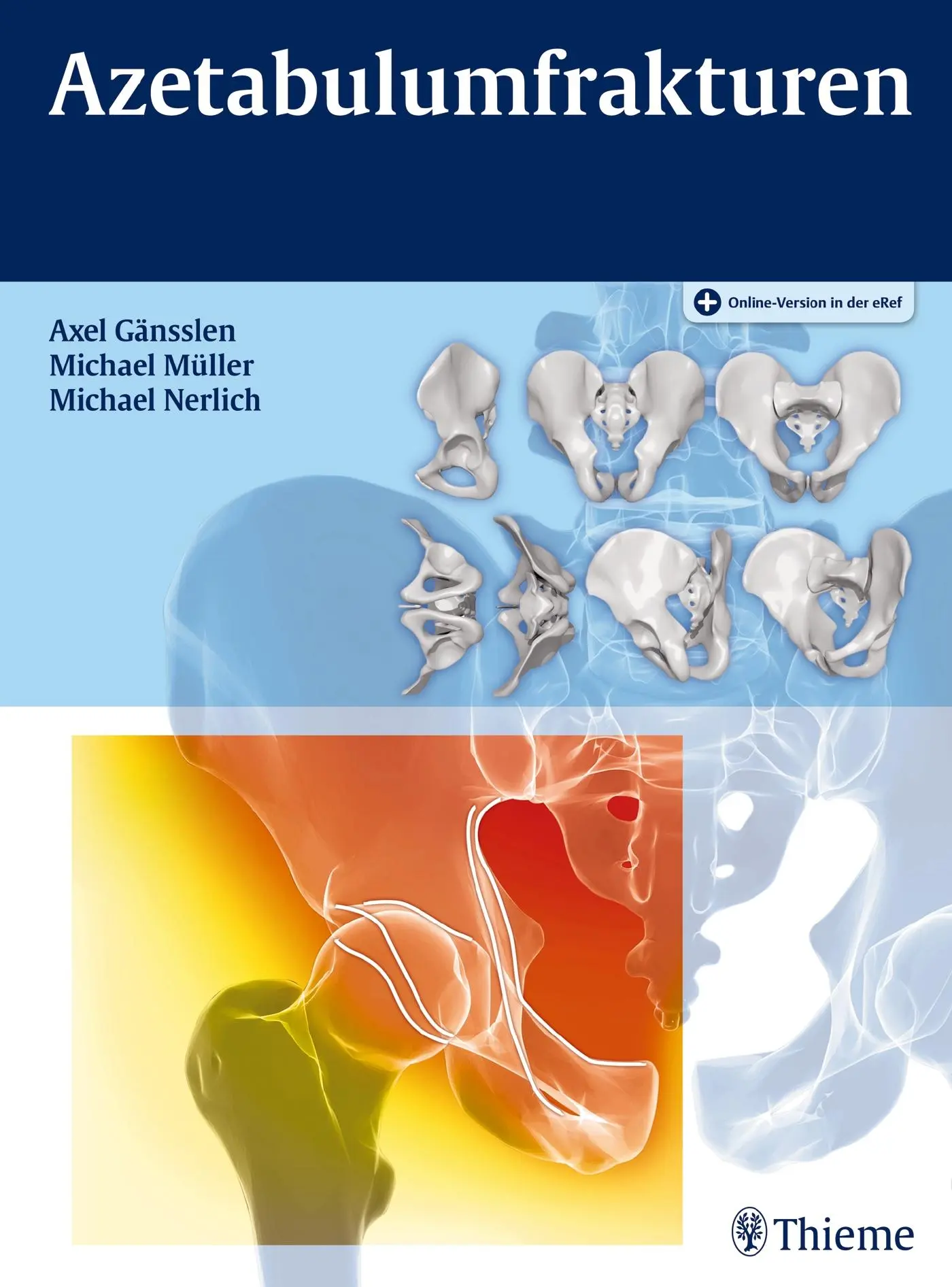 Cover: 9783132047419 | Azetabulumfrakturen | Axel Gänsslen (u. a.) | Bundle | 1 Buch | 2015