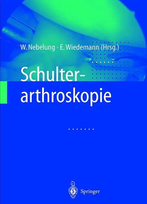 Cover: 9783662098219 | Schulterarthroskopie | Wolfgang Nebelung (u. a.) | Taschenbuch | xvii