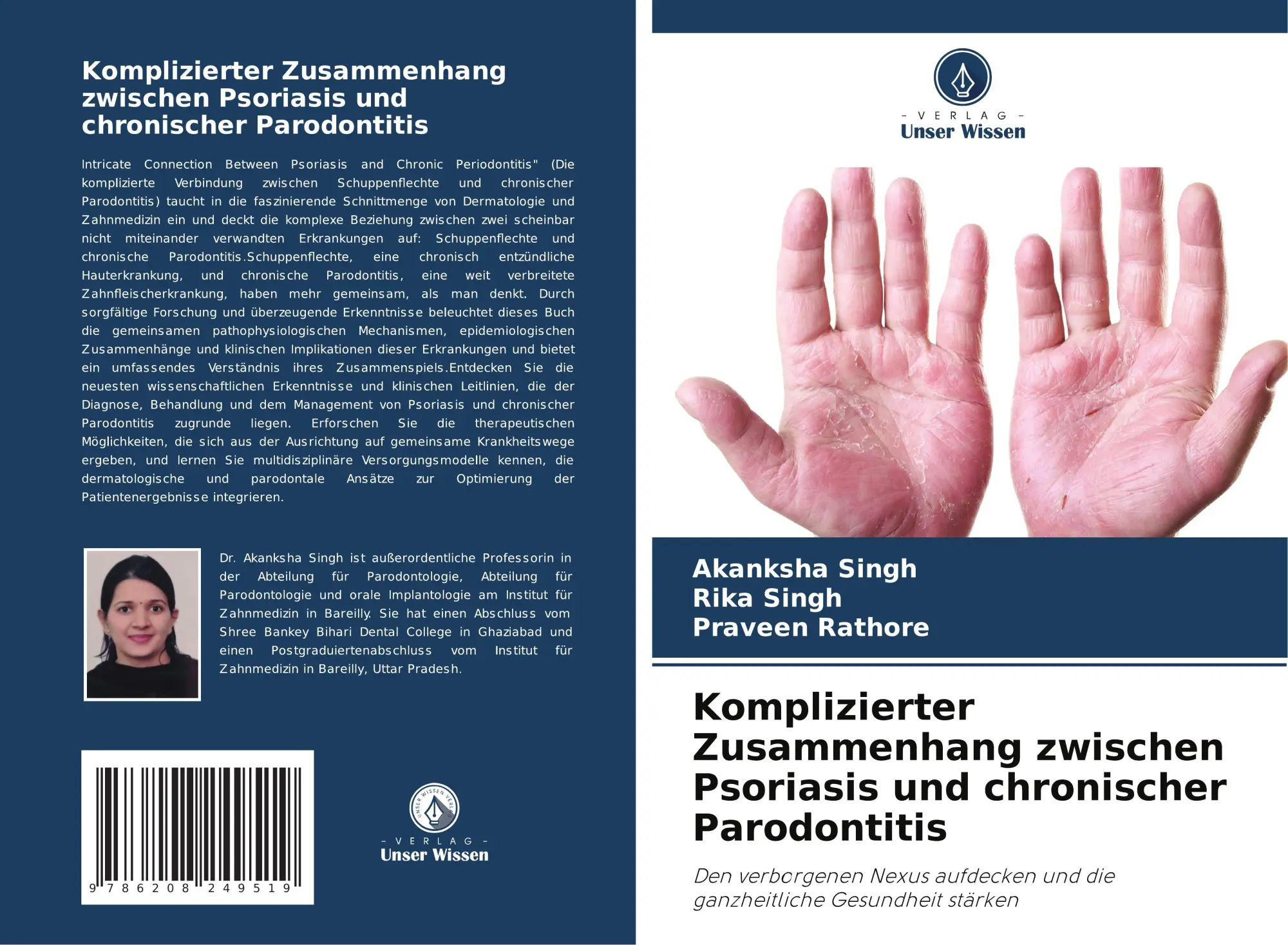 Cover: 9786208249519 | Komplizierter Zusammenhang zwischen Psoriasis und chronischer...