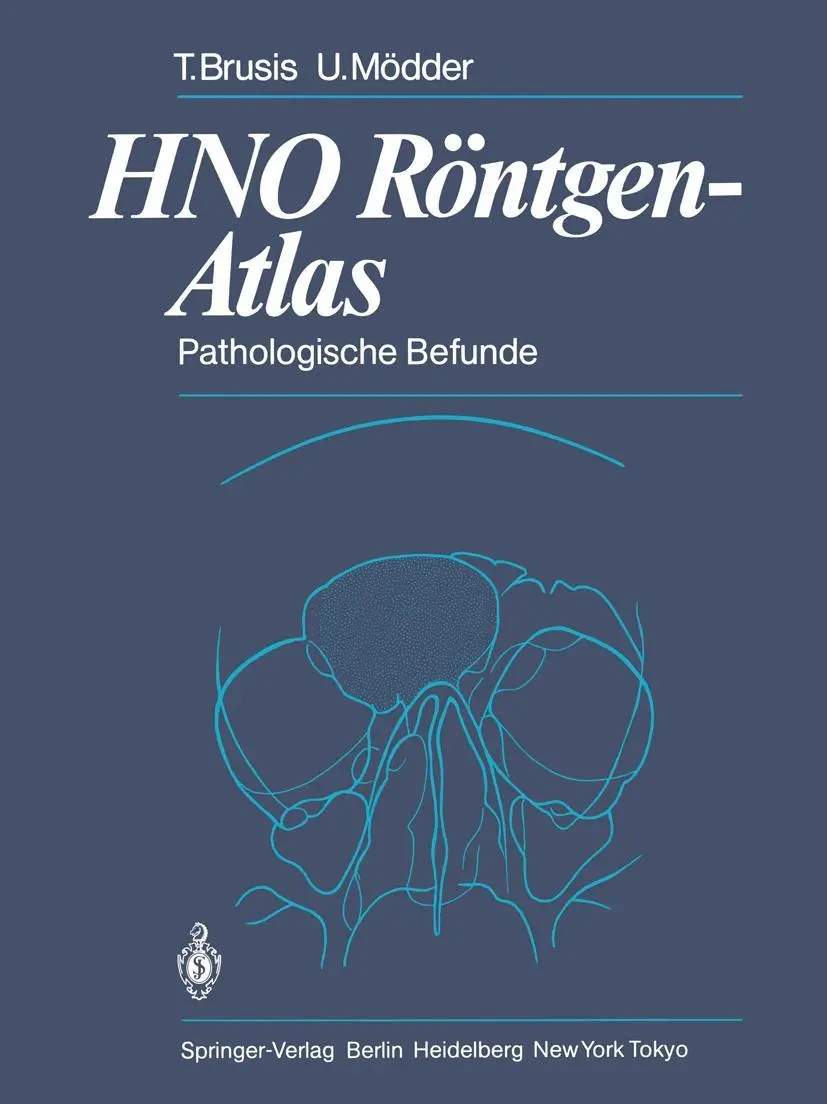 Cover: 9783642692420 | HNO Röntgen-Atlas | Pathologische Befunde | Tilman Brusis (u. a.) | x