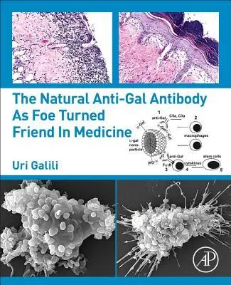 Cover: 9780128133620 | The Natural Anti-Gal Antibody as Foe Turned Friend in Medicine | Buch