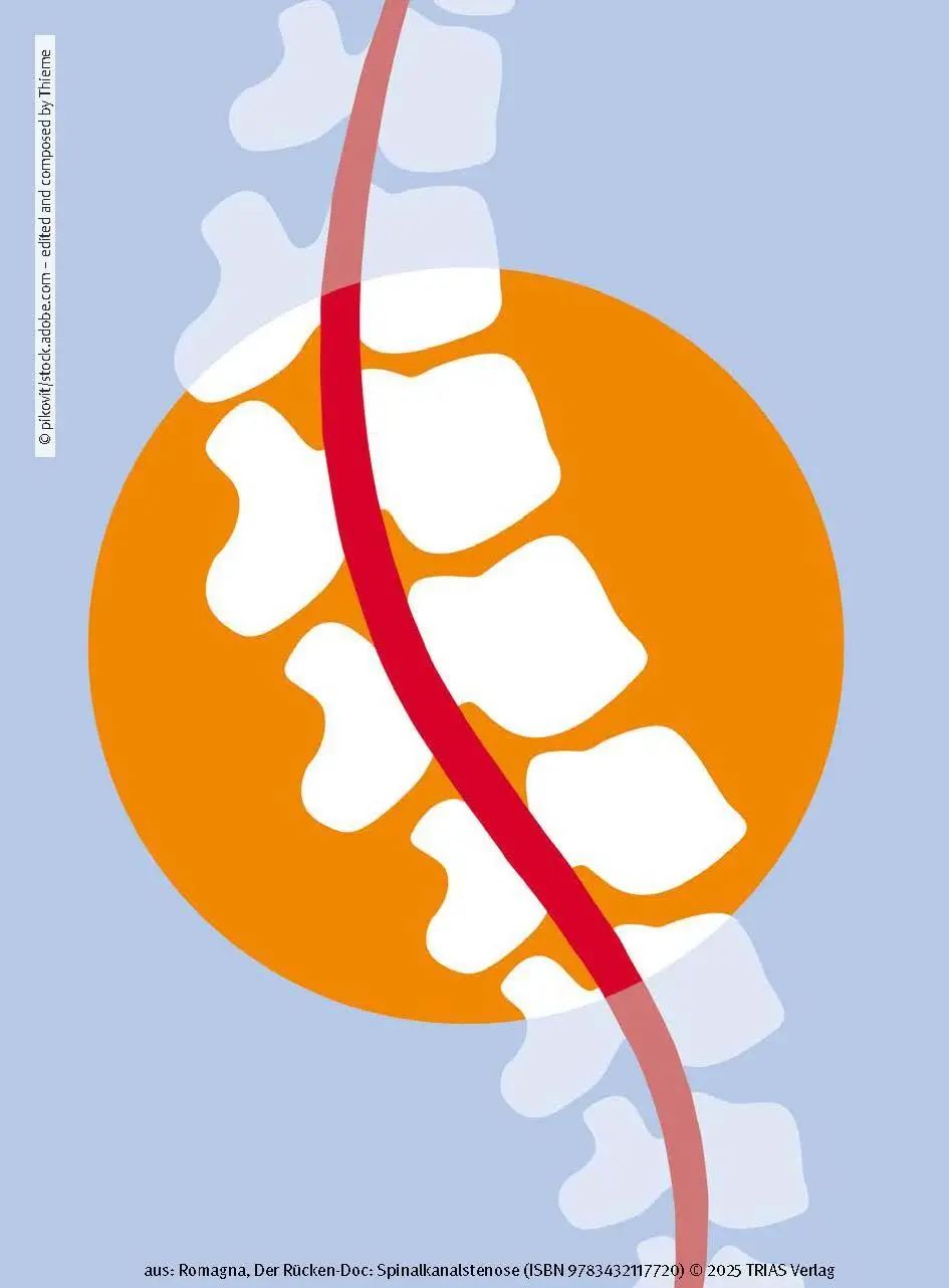 Bild: 9783432117720 | Der Rücken-Doc: Spinalkanalstenose | Alexander Romagna | Taschenbuch
