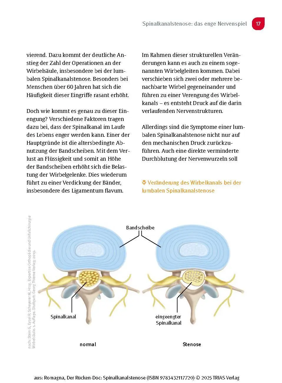 Bild: 9783432117720 | Der Rücken-Doc: Spinalkanalstenose | Alexander Romagna | Taschenbuch