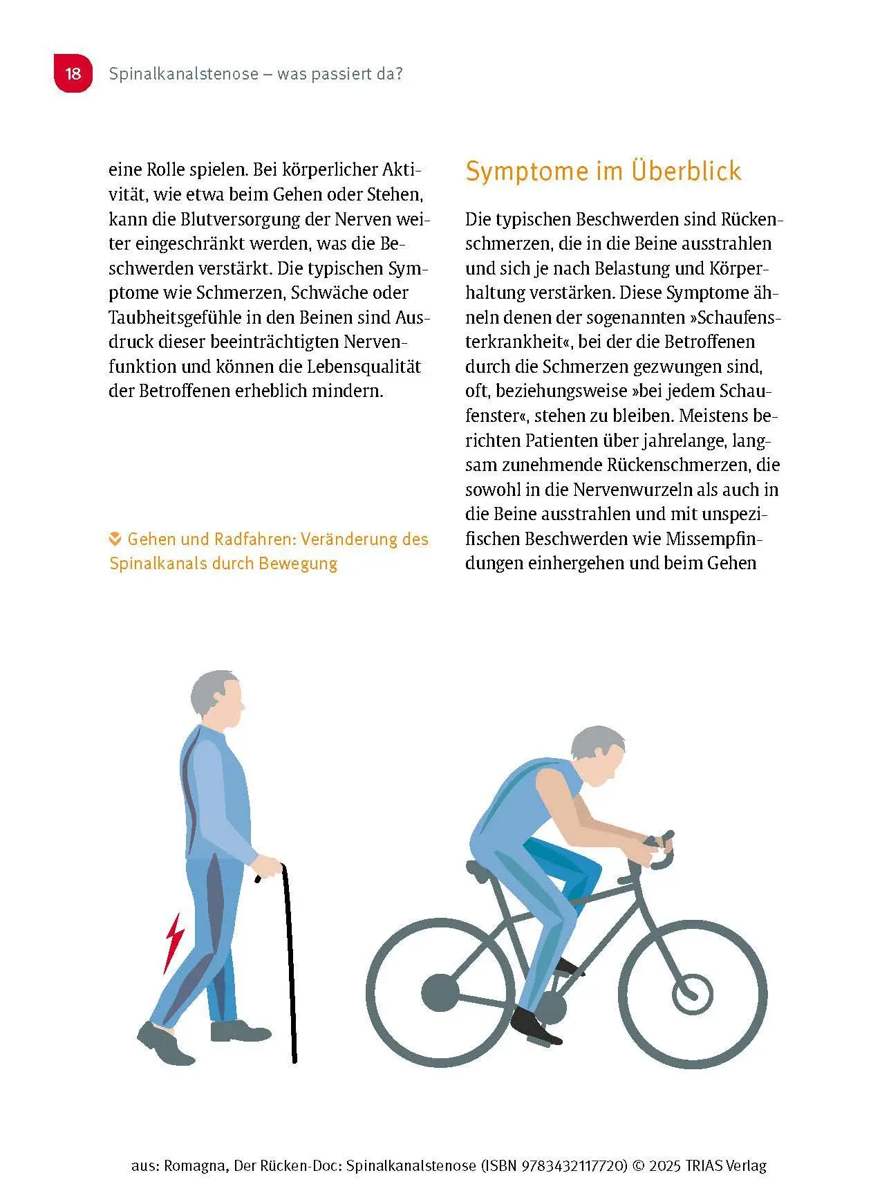 Bild: 9783432117720 | Der Rücken-Doc: Spinalkanalstenose | Alexander Romagna | Taschenbuch