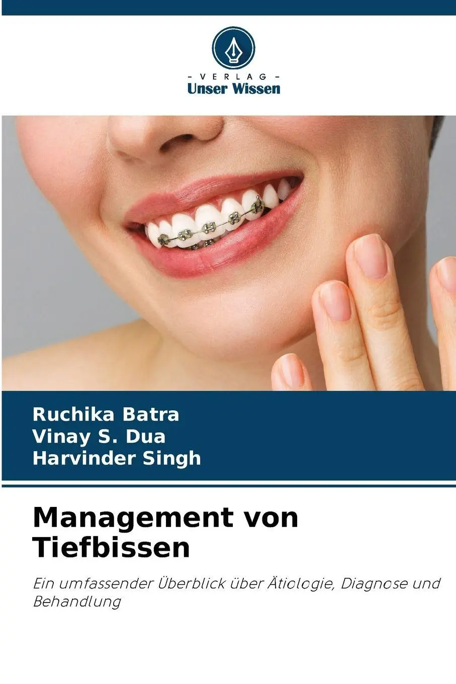Cover: 9786209089220 | Management von Tiefbissen | Ruchika Batra (u. a.) | Taschenbuch | 2026