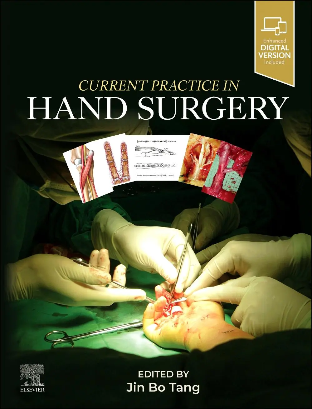 Cover: 9780443109720 | Current Practice in Hand Surgery | Jin Bo Tang (u. a.) | Buch | 2025
